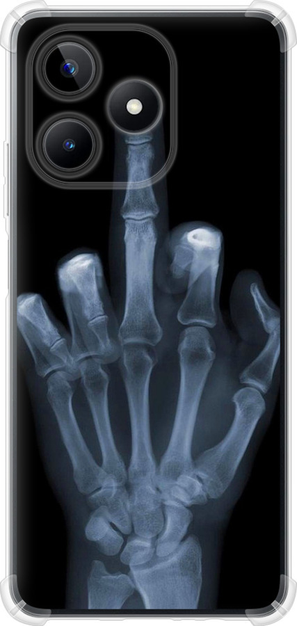 Рука через рентген