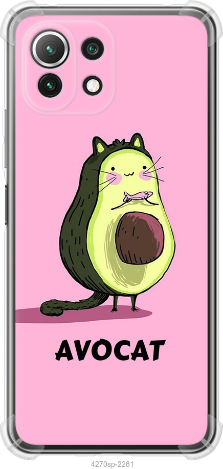 Avocat