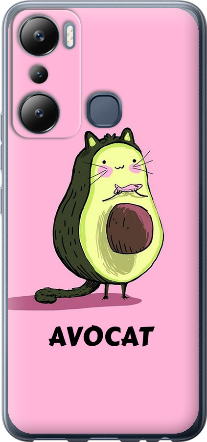 Avocat